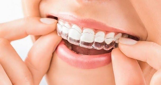 هر آنچه باید درباره ی عوارض دندان قروچه بدانیم