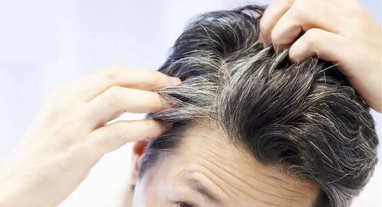 آیا این ترفند موی سفید را ریشه کن می کند؟/ عوامل پنهان در سفیدی زود هنگام مو